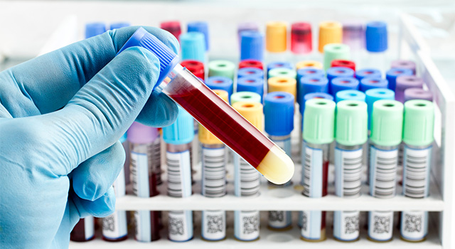 Phlebotomy service